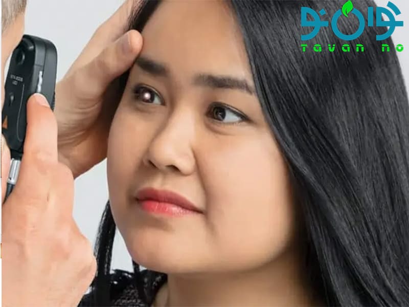  مقایسه بین افتالموسکوپ مستقیم و غیر مستقیم و انواع آن ها