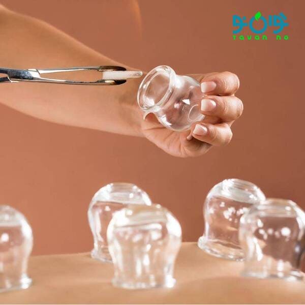 خرید لیوان حجامت مدرن