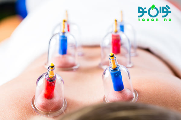 قیمت لیوان حجامت