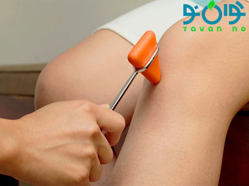 رفلکس‌های عصبی قابل بررسی با چکش پزشکی: از دانش تا تجربه بالینی