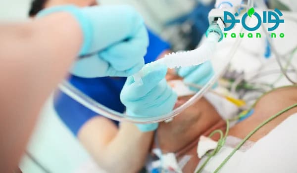 عوارض احتمالی ساکشن