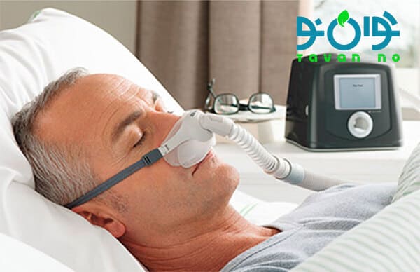 مدت استفاده از CPAP تا چه زمانی ادامه دارد