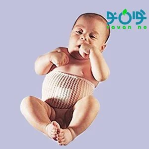 سرجی فیکس نوزاد