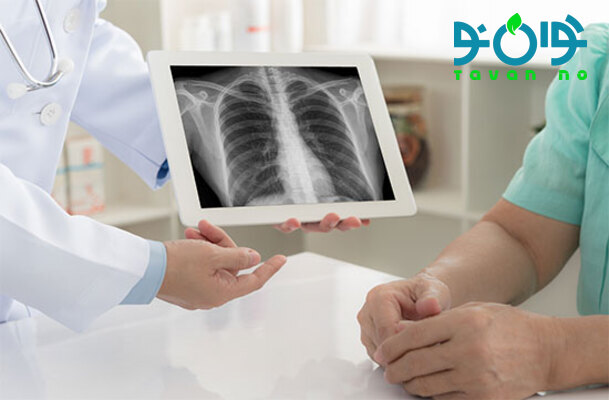 علائم ذات الریه