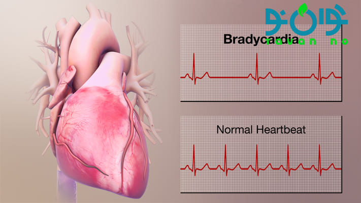 ضربان قلب نرمال در بزرگسالان