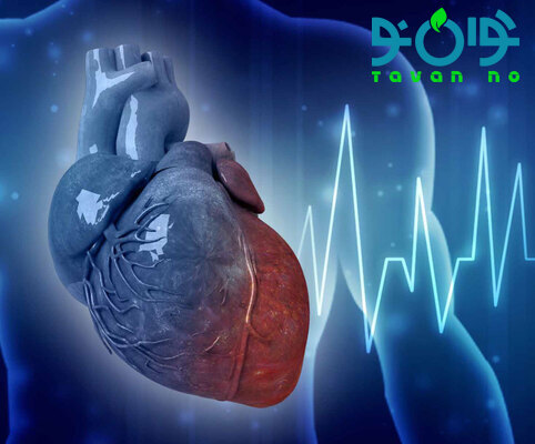 علائم آریتمی قلبی